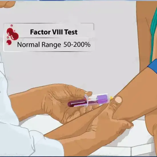 Factor VIII Functional Activity Test